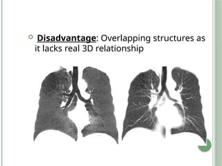  Disadvantage: Overlapping structures as
it lacks real 3D relationship
 