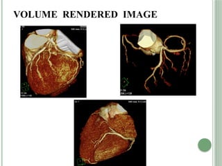 VOLUME RENDERED IMAGE
 