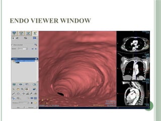 ENDO VIEWER WINDOW
 