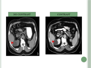 NO CONTRAST CONTRAST
 