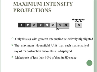 MAXIMUM INTENSITY
PROJECTIONS
 Only tissues with greatest attenuation selectively highlighted
 The maximum Hounsfield Unit that each mathematical
ray of reconstruction encounters is displayed
 Makes use of less than 10% of data in 3D space
 