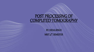 POST PROCESSING OF
COMPUTED TOMOGRAPHY
BY: NEHASINGH
MRIT 3RD SEMESTER
 