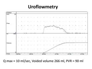 Uroflowmetry
Q max = 10 ml/sec, Voided volume 266 ml, PVR = 90 ml
 