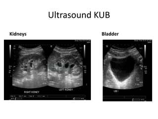 Ultrasound KUB
Kidneys Bladder
 