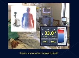 Sistema intravascular Coolgard Alsius®  