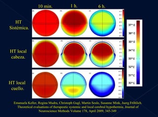10 min. 1 h. 6 h. HT local cabeza. HT  Sistémica. Emanuela Keller, Regina Mudra, Christoph Gugl, Martin Seule, Susanne Mink, Juerg Fröhlich.  Theoretical evaluations of therapeutic systemic and local cerebral hypothermia .  Journal of Neuroscience Methods Volume 178, April 2009, 345-349  HT local  cuello. 