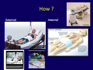 How ?
External      Internal
 