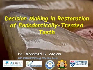 Decision Making in Restoration
of Endodontically-Treated
Teeth
Dr. Mohamed S. Zeglam
BDS, MFDS RCPS(Glasg), MSc (Rest Dent)
 