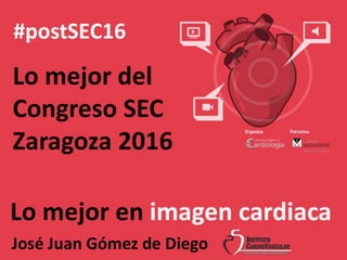Lo mejor del Congreso SEC Zaragoza 2016
Imagen Cardiaca
 