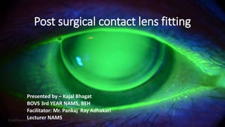 Post surgical contact lens fitting
Presented by – Kajal Bhagat
BOVS 3rd YEAR NAMS, BEH
Facilitator: Mr. Pankaj Ray Adhakari
Lecturer NAMS
 