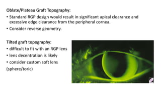 Edge Clearance Rgp Post surgical contact lens.pptx