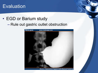 Evaluation
• EGD or Barium study
– Rule out gastric outlet obstruction

 