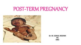 POST-TERM PREGNANCY
Dr. M. GOKUL RESHMI
PG
OBG
 