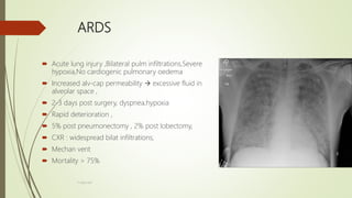 ARDS
 Acute lung injury ,Bilateral pulm infiltrations,Severe
hypoxia,No cardiogenic pulmonary oedema
 Increased alv-cap permeability  excessive fluid in
alveolar space ,
 2-3 days post surgery, dyspnea,hypoxia
 Rapid deterioration ,
 5% post pneumonectomy , 2% post lobectomy,
 CXR : widespread bilat infiltrations,
 Mechan vent
 Mortality > 75%
F.Aljanadi
 