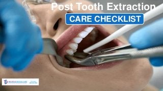 Post Tooth Extraction
CARE CHECKLIST
 