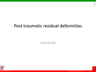 © Ramaiah University of Applied Sciences
1
Faculty of Dental Sciences
University
Logo
Post traumatic residual deformities
-ZEESHAN ARIF
 
