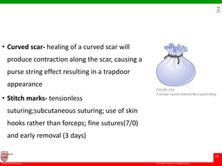 © Ramaiah University of Applied Sciences
10
Faculty of Dental Sciences
University
Logo
• Curved scar- healing of a curved scar will
produce contraction along the scar, causing a
purse string effect resulting in a trapdoor
appearance
• Stitch marks- tensionless
suturing;subcutaneous suturing; use of skin
hooks rather than forceps; fine sutures(7/0)
and early removal (3 days)
 