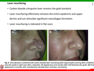 © Ramaiah University of Applied Sciences
19
Faculty of Dental Sciences
University
Logo
Laser resurfacing
• Carbon dioxide ultrapulse laser remains the gold standard.
• Laser resurfacing effectively removes the entire epidermis and upper
dermis and can stimulate significant neocollagen formation.
• Laser resurfacing is indicated in flat scars
 