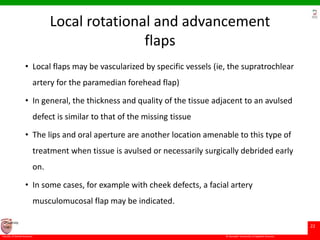 © Ramaiah University of Applied Sciences
22
Faculty of Dental Sciences
University
Logo
Local rotational and advancement
flaps
• Local flaps may be vascularized by specific vessels (ie, the supratrochlear
artery for the paramedian forehead flap)
• In general, the thickness and quality of the tissue adjacent to an avulsed
defect is similar to that of the missing tissue
• The lips and oral aperture are another location amenable to this type of
treatment when tissue is avulsed or necessarily surgically debrided early
on.
• In some cases, for example with cheek defects, a facial artery
musculomucosal flap may be indicated.
 