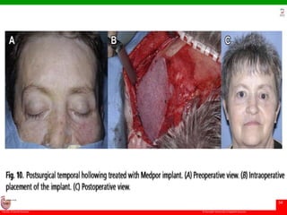 © Ramaiah University of Applied Sciences
34
Faculty of Dental Sciences
University
Logo
 