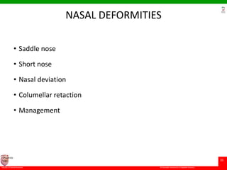 © Ramaiah University of Applied Sciences
35
Faculty of Dental Sciences
University
Logo
NASAL DEFORMITIES
• Saddle nose
• Short nose
• Nasal deviation
• Columellar retaction
• Management
 