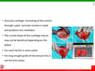 © Ramaiah University of Applied Sciences
43
Faculty of Dental Sciences
University
Logo
• Auricular cartilage- harvesting of the concha
through a post- auricular incision is rapid
and produces less morbidity
• The curved shape of this cartilage may or
may not be beneficial depending on the
defect
• For nasal tip this is most useful
• For long straight grafts of the dorsum this is
not the first choice
 