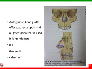 © Ramaiah University of Applied Sciences
45
Faculty of Dental Sciences
University
Logo
• Autogenous bone grafts
offer greater support and
augmentation that is used
in larger defects
• Rib
• iliac crest
• calvarium
 