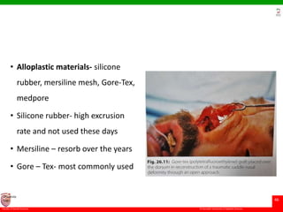 © Ramaiah University of Applied Sciences
46
Faculty of Dental Sciences
University
Logo
• Alloplastic materials- silicone
rubber, mersiline mesh, Gore-Tex,
medpore
• Silicone rubber- high excrusion
rate and not used these days
• Mersiline – resorb over the years
• Gore – Tex- most commonly used
 