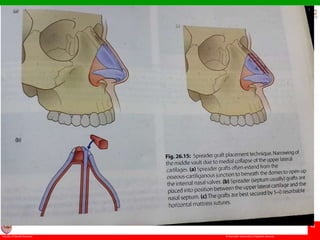 © Ramaiah University of Applied Sciences
48
Faculty of Dental Sciences
University
Logo
 