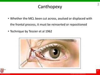 © Ramaiah University of Applied Sciences
54
Faculty of Dental Sciences
University
Logo
Canthopexy
• Whether the MCL been cut across, avulsed or displaced with
the frontal process, it must be reinserted or repositioned
• Technique by Tessier et al 1962
 