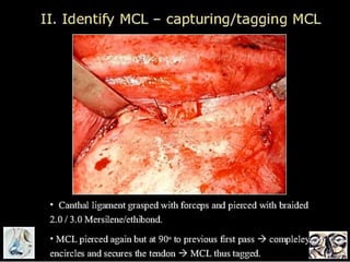 © Ramaiah University of Applied Sciences
55
Faculty of Dental Sciences
University
Logo
 
