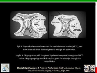 © Ramaiah University of Applied Sciences
56
Faculty of Dental Sciences
University
Logo
 