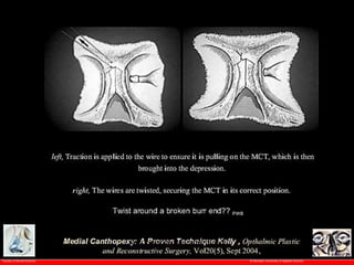 © Ramaiah University of Applied Sciences
57
Faculty of Dental Sciences
University
Logo
 