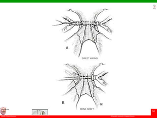 © Ramaiah University of Applied Sciences
58
Faculty of Dental Sciences
University
Logo
 