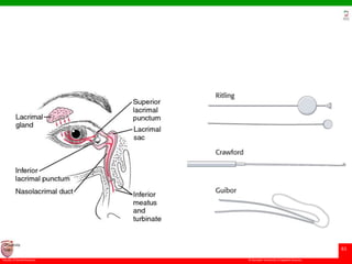 © Ramaiah University of Applied Sciences
61
Faculty of Dental Sciences
University
Logo
 