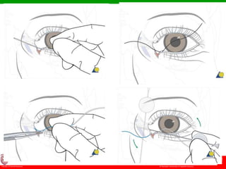© Ramaiah University of Applied Sciences
62
Faculty of Dental Sciences
University
Logo
 