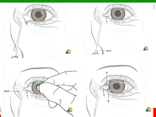© Ramaiah University of Applied Sciences
63
Faculty of Dental Sciences
University
Logo
 
