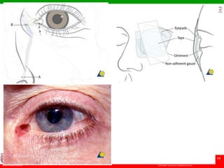 © Ramaiah University of Applied Sciences
64
Faculty of Dental Sciences
University
Logo
 