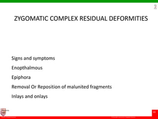 © Ramaiah University of Applied Sciences
65
Faculty of Dental Sciences
University
Logo
ZYGOMATIC COMPLEX RESIDUAL DEFORMITIES
Signs and symptoms
Enopthalmous
Epiphora
Removal Or Reposition of malunited fragments
Inlays and onlays
 