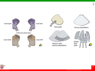 © Ramaiah University of Applied Sciences
69
Faculty of Dental Sciences
University
Logo
 