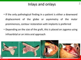 © Ramaiah University of Applied Sciences
71
Faculty of Dental Sciences
University
Logo
Inlays and onlays
• If the only pathological finding in a patient is either a downward
displacement of the globe or asymmetry of the malar
prominences, contour restoration with implants is preferred
• Depending on the size of the graft, this is placed on zygoma using
infraorbital or an intra oral approach
 