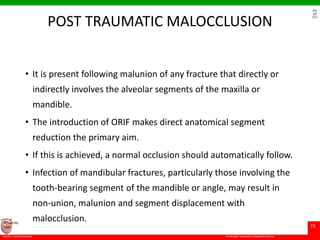 © Ramaiah University of Applied Sciences
73
Faculty of Dental Sciences
University
Logo
POST TRAUMATIC MALOCCLUSION
• It is present following malunion of any fracture that directly or
indirectly involves the alveolar segments of the maxilla or
mandible.
• The introduction of ORIF makes direct anatomical segment
reduction the primary aim.
• If this is achieved, a normal occlusion should automatically follow.
• Infection of mandibular fractures, particularly those involving the
tooth-bearing segment of the mandible or angle, may result in
non-union, malunion and segment displacement with
malocclusion.
 