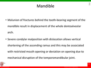 © Ramaiah University of Applied Sciences
76
Faculty of Dental Sciences
University
Logo
Mandible
• Malunion of fractures behind the tooth-bearing segment of the
mandible result in displacement of the whole dentoalveolar
arch.
• Severe condylar malposition with dislocation allows vertical
shortening of the ascending ramus and this may be associated
with restricted mouth opening or deviation on opening due to
mechanical disruption of the temporomandibular joint.
 