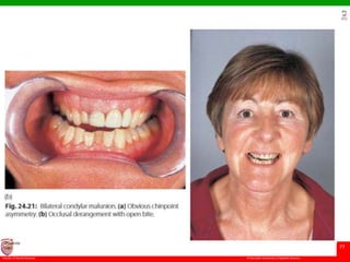 © Ramaiah University of Applied Sciences
77
Faculty of Dental Sciences
University
Logo
 