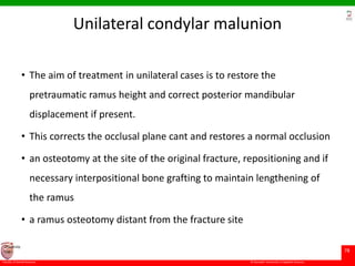 © Ramaiah University of Applied Sciences
78
Faculty of Dental Sciences
University
Logo
Unilateral condylar malunion
• The aim of treatment in unilateral cases is to restore the
pretraumatic ramus height and correct posterior mandibular
displacement if present.
• This corrects the occlusal plane cant and restores a normal occlusion
• an osteotomy at the site of the original fracture, repositioning and if
necessary interpositional bone grafting to maintain lengthening of
the ramus
• a ramus osteotomy distant from the fracture site
 