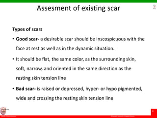 © Ramaiah University of Applied Sciences
8
Faculty of Dental Sciences
University
Logo
Assesment of existing scar
Types of scars
• Good scar- a desirable scar should be inscospicuous with the
face at rest as well as in the dynamic situation.
• It should be flat, the same color, as the surrounding skin,
soft, narrow, and oriented in the same direction as the
resting skin tension line
• Bad scar- is raised or depressed, hyper- or hypo pigmented,
wide and crossing the resting skin tension line
 