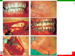 © Ramaiah University of Applied Sciences
80
Faculty of Dental Sciences
University
Logo
 