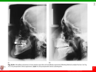 © Ramaiah University of Applied Sciences
82
Faculty of Dental Sciences
University
Logo
 