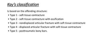 Kay Classification Posttraumatic stiff elbow | PPTX