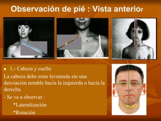 Observación de pié : Vista anterior
 1.- Cabeza y cuello
La cabeza debe estar levantada sin una
desviación notable hacía la izquierda o hacía la
derecha.
- Se va a observar :
*Lateralización
*Rotación
 